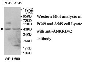 ANKRD42 Antibody