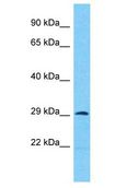 ANKRD44 Antibody - ANKRD44 antibody Western Blot of 721_B. Antibody dilution: 1 ug/ml.  This image was taken for the unconjugated form of this product. Other forms have not been tested.