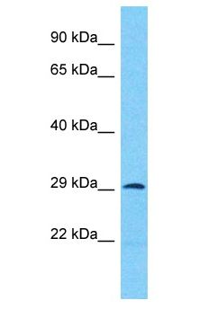 ANKRD44 Antibody - ANKRD44 antibody Western Blot of 721_B. Antibody dilution: 1 ug/ml.  This image was taken for the unconjugated form of this product. Other forms have not been tested.