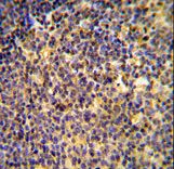 ANKRD44 Antibody - ANR44 Antibody immunohistochemistry of formalin-fixed and paraffin-embedded human tonsil tissue followed by peroxidase-conjugated secondary antibody and DAB staining.