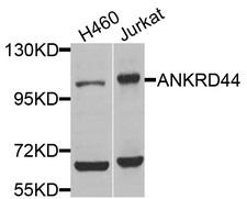 ANKRD44 Antibody - Western blot analysis of extracts of various cells.