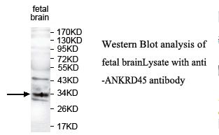 ANKRD45 Antibody