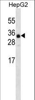 ANKRD46 Antibody - ANR46 Antibody western blot of HepG2 cell line lysates (35 ug/lane). The ANR46 antibody detected the ANR46 protein (arrow).