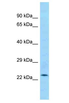 ANKRD46 Antibody - ANKRD46 antibody Western Blot of Mouse Small Intestine. Antibody dilution: 1 ug/ml.  This image was taken for the unconjugated form of this product. Other forms have not been tested.
