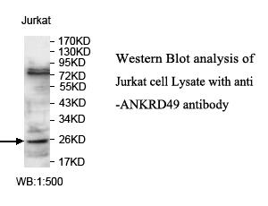 ANKRD49 Antibody