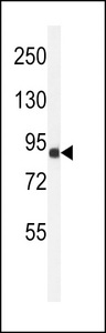ANKRD49 Antibody - Western blot of ANR49 Antibody in Jurkat cell line lysates (35 ug/lane). ANR49 (arrow) was detected using the purified antibody.