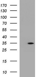 ANKRD49 Antibody - HEK293T cells were transfected with the pCMV6-ENTRY control (Left lane) or pCMV6-ENTRY ANKRD49 (Right lane) cDNA for 48 hrs and lysed. Equivalent amounts of cell lysates (5 ug per lane) were separated by SDS-PAGE and immunoblotted with anti-ANKRD49.