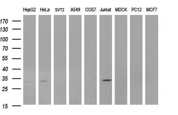 ANKRD49 Antibody - Western blot of extracts (35ug) from 9 different cell lines by using anti-ANKRD49 monoclonal antibody (HepG2: human; HeLa: human; SVT2: mouse; A549: human; COS7: monkey; Jurkat: human; MDCK: canine; PC12: rat; MCF7: human).