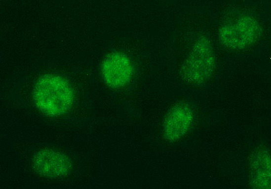 ANKRD49 Antibody - Immunofluorescent staining of HeLa cells using anti-ANKRD49 mouse monoclonal antibody.