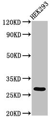 ANKRD49 Antibody - Western Blot Positive WB detected in: HEK293 whole cell lysate All lanes: ANKRD49 antibody at 3µg/ml Secondary Goat polyclonal to rabbit IgG at 1/50000 dilution Predicted band size: 28 kDa Observed band size: 28 kDa