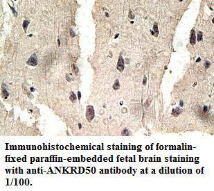 ANKRD50 Antibody