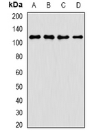 ANKRD52 Antibody - Western blot analysis of ANR52 expression in A549 (A); K562 (B); mouse brain (C); rat liver (D) whole cell lysates.