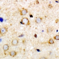 ANKRD52 Antibody - Immunohistochemical analysis of ANR52 staining in mouse brain formalin fixed paraffin embedded tissue section. The section was pre-treated using heat mediated antigen retrieval with sodium citrate buffer (pH 6.0). The section was then incubated with the antibody at room temperature and detected using an HRP conjugated compact polymer system. DAB was used as the chromogen. The section was then counterstained with hematoxylin and mounted with DPX.