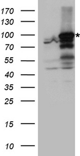 ANKRD52 Antibody - HEK293T cells were transfected with the pCMV6-ENTRY control. (Left lane) or pCMV6-ENTRY ANKRD52. (Right lane) cDNA for 48 hrs and lysed