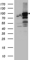 ANKRD52 Antibody - HEK293T cells were transfected with the pCMV6-ENTRY control. (Left lane) or pCMV6-ENTRY ANKRD52. (Right lane) cDNA for 48 hrs and lysed