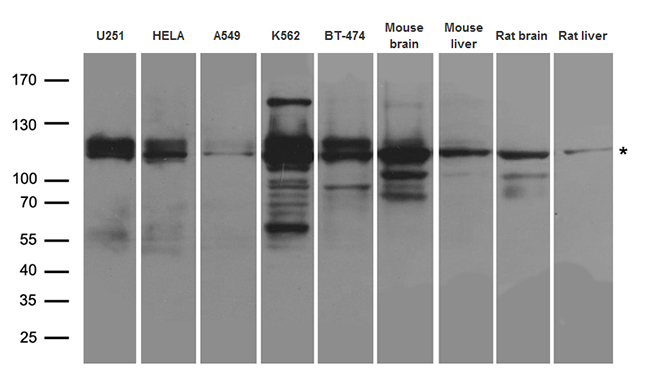 ANKRD52 Antibody - Western blot analysis of extracts. (35ug) from different cell lines and tissues by using anti-ANKRD52 rabbit polyclonal antibody.