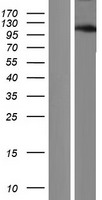 ANKRD52 Protein - Western validation with an anti-DDK antibody * L: Control HEK293 lysate R: Over-expression lysate