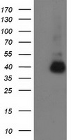 ANKRD53 Antibody - HEK293T cells were transfected with the pCMV6-ENTRY control (Left lane) or pCMV6-ENTRY ANKRD53 (Right lane) cDNA for 48 hrs and lysed. Equivalent amounts of cell lysates (5 ug per lane) were separated by SDS-PAGE and immunoblotted with anti-ANKRD53.