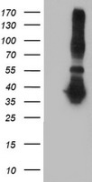 ANKRD53 Antibody - HEK293T cells were transfected with the pCMV6-ENTRY control (Left lane) or pCMV6-ENTRY ANKRD53 (Right lane) cDNA for 48 hrs and lysed. Equivalent amounts of cell lysates (5 ug per lane) were separated by SDS-PAGE and immunoblotted with anti-ANKRD53.