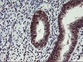 ANKRD53 Antibody - IHC of paraffin-embedded Human endometrium tissue using anti-ANKRD53 mouse monoclonal antibody.
