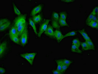 ANKRD55 Antibody - Immunofluorescent analysis of Hela cells using ANKRD55 Antibody at dilution of 1:100 and Alexa Fluor 488-congugated AffiniPure Goat Anti-Rabbit IgG(H+L)