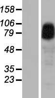 ANKRD6 / Diversin Protein - Western validation with an anti-DDK antibody * L: Control HEK293 lysate R: Over-expression lysate