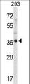 ANKRD60 Antibody - ANKRD60 Antibody western blot of 293 cell line lysates (35 ug/lane). The ANKRD60 antibody detected the ANKRD60 protein (arrow).