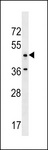 ANKRD61 Antibody - ANKRD61 Antibody western blot of A549 cell line lysates (35 ug/lane). The ANKRD61 antibody detected the ANKRD61 protein (arrow).