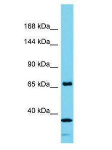 ANKRD62 Antibody - ANKRD62 antibody Western Blot of Fetal Heart. Antibody dilution: 1 ug/ml.  This image was taken for the unconjugated form of this product. Other forms have not been tested.