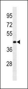 ANKRD63 Antibody - ANKRD63 Antibody western blot of A375 cell line lysates (35 ug/lane). The ANKRD63 antibody detected the ANKRD63 protein (arrow).