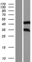 ANKRD63 Protein - Western validation with an anti-DDK antibody * L: Control HEK293 lysate R: Over-expression lysate