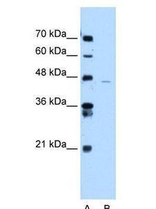 ANKRD65 Antibody - ANKRD65 antibody Western Blot of Jurkat cell lysate.  This image was taken for the unconjugated form of this product. Other forms have not been tested.