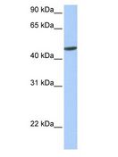 ANKRD65 Antibody - ANKRD65 antibody Western Blot of Human Muscle.  This image was taken for the unconjugated form of this product. Other forms have not been tested.