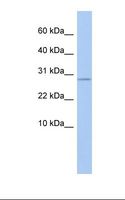 ANKRD7 Antibody - Placenta lysate. Antibody concentration: 1.0 ug/ml. Gel concentration: 10-20%.  This image was taken for the unconjugated form of this product. Other forms have not been tested.