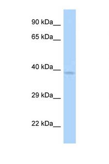 ANKRD9 Antibody - ANKRD9 antibody Western blot of Small Intestine lysate. Antibody concentration 1 ug/ml.  This image was taken for the unconjugated form of this product. Other forms have not been tested.