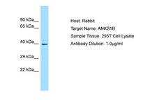 ANKS1B Antibody -  This image was taken for the unconjugated form of this product. Other forms have not been tested.