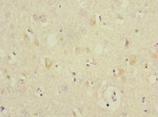ANKS1B Antibody - Immunohistochemistry of paraffin-embedded human brain tissue at dilution 1:100