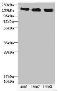 ANKS1B Antibody - Western blot All Lanes: ANKS1B antibody at 5.28ug/ml Lane 1: 293T whole cell lysate Lane 2: HepG-2 whole cell lysate Lane 3: Hela whole cell lysate Secondary Goat polyclonal to rabbit IgG at 1/10000 dilution Predicted band size: 139,49,58,53,52,86,48,41,29,45 kDa Observed band size: 138 kDa