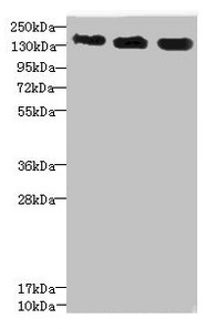 ANKS1B Antibody - Western blot All lanes: ANKS1B antibody at 5.28µg/ml Lane 1: 293T whole cell lysate Lane 2: HepG2 whole cell lysate Lane 3: Hela whole cell lysate Secondary Goat polyclonal to rabbit IgG at 1/10000 dilution Predicted band size: 139, 49, 58, 53, 52, 86, 48, 41, 29, 45 kDa Observed band size: 139 kDa