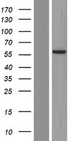 ANKS1B Protein - Western validation with an anti-DDK antibody * L: Control HEK293 lysate R: Over-expression lysate