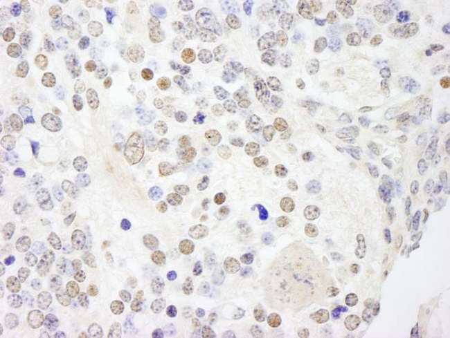 ANKS3 Antibody - Detection of Mouse ANKS3 by Immunohistochemistry. Sample: FFPE section of mouse teratoma. Antibody: Affinity purified rabbit anti-ANKS3 used at a dilution of 1:250.