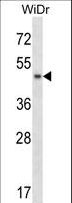 ANKS4B Antibody - ANKS4B Antibody western blot of WiDr cell line lysates (35 ug/lane). The ANKS4B antibody detected the ANKS4B protein (arrow).