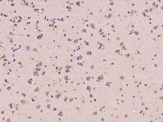 ANKS6 Antibody - Immunochemical staining of human ANKS6 in human brain with rabbit polyclonal antibody at 1:500 dilution, formalin-fixed paraffin embedded sections.