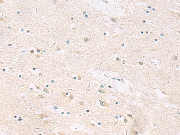 ANKS6 Antibody - Immunohistochemistry of paraffin-embedded Human brain tissue  using ANKS6 Polyclonal Antibody at dilution of 1:55(×200)