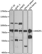 ANKZF1 Antibody - Western blot analysis of extracts of various cell lines, using ANKZF1 antibody at 1:3000 dilution. The secondary antibody used was an HRP Goat Anti-Rabbit IgG (H+L) at 1:10000 dilution. Lysates were loaded 25ug per lane and 3% nonfat dry milk in TBST was used for blocking. An ECL Kit was used for detection and the exposure time was 60s.