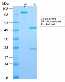 ANO1 / DOG1 / TMEM16A Antibody - SDS-PAGE Analysis Purified DOG-1 Rabbit Recombinant Monoclonal Antibody (DG1/2564R). Confirmation of Purity and Integrity of Antibody.