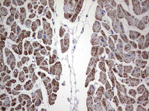 ANO1 / DOG1 / TMEM16A Antibody - Immunohistochemical staining of paraffin-embedded Human adult heart tissue using anti-ANO1 mouse monoclonal antibody. (Heat-induced epitope retrieval by 1 mM EDTA in 10mM Tris, pH8.5, 120C for 3min,