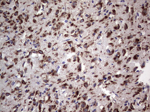 ANO1 / DOG1 / TMEM16A Antibody - Immunohistochemical staining of paraffin-embedded Human adult brain tissue using anti-ANO1 mouse monoclonal antibody. (Heat-induced epitope retrieval by 1 mM EDTA in 10mM Tris, pH8.5, 120C for 3min,