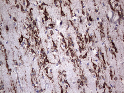 ANO1 / DOG1 / TMEM16A Antibody - Immunohistochemical staining of paraffin-embedded Human embryonic brain cortex tissue using anti-ANO1 mouse monoclonal antibody. (Heat-induced epitope retrieval by 1 mM EDTA in 10mM Tris, pH8.5, 120C for 3min,