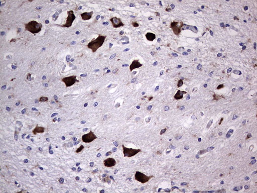ANO1 / DOG1 / TMEM16A Antibody - Immunohistochemical staining of paraffin-embedded Human embryonic cerebellum using anti-ANO1 mouse monoclonal antibody. (Heat-induced epitope retrieval by 1 mM EDTA in 10mM Tris, pH8.5, 120C for 3min,